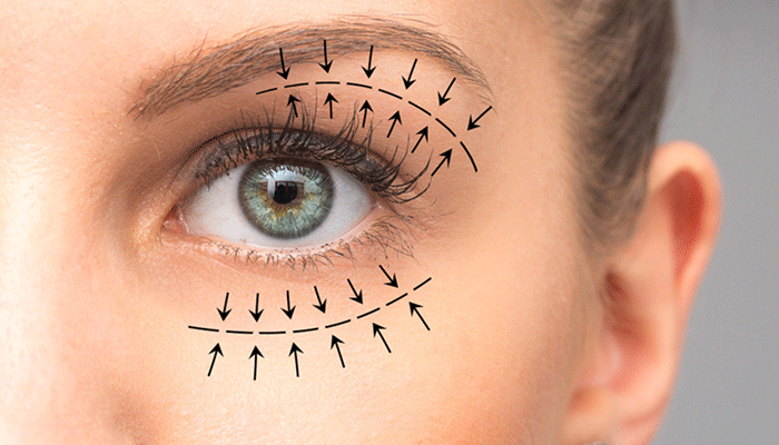 Best Oculoplasty Procedure in Thane Dr.Neeta Maske