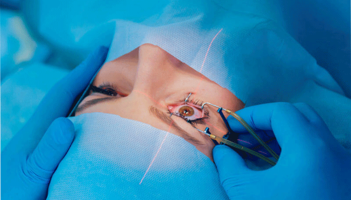 Best Refractive or LASIK procedure in Thane by Dr. Neeta Maske at Icon Vision Clinic.
